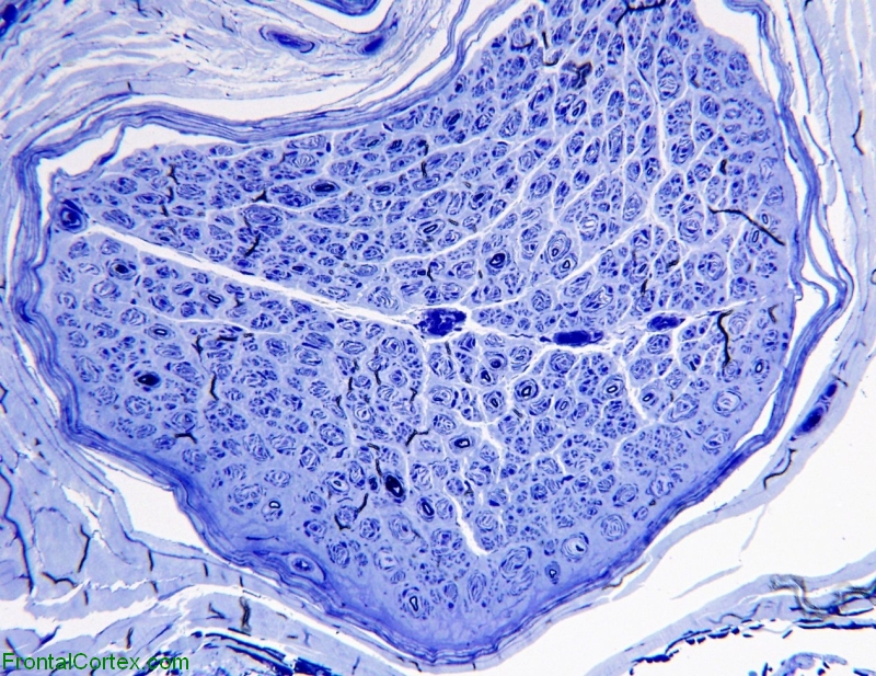 Toluidine Blue stain plastic embedded nerve 200x